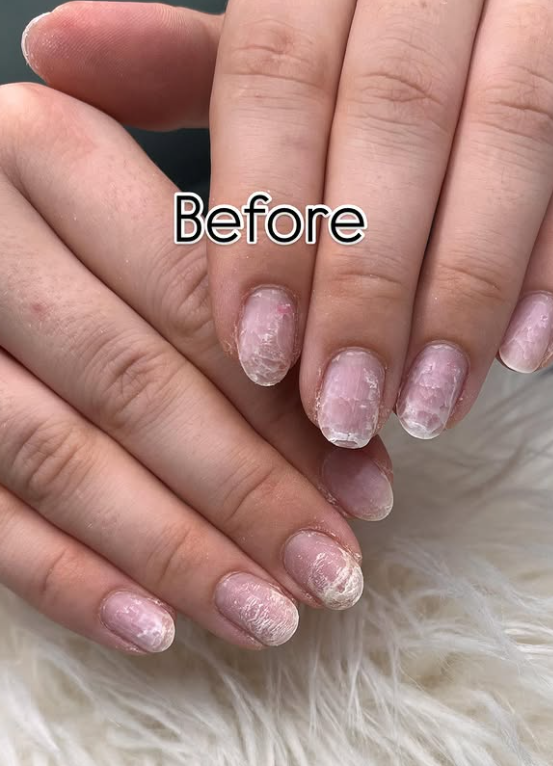 Before nail transformation set 2 at Trevi Salon JVC Dubai